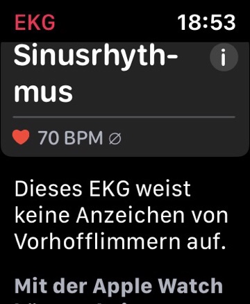 Hinweis auf Ergebnis eines EKGs