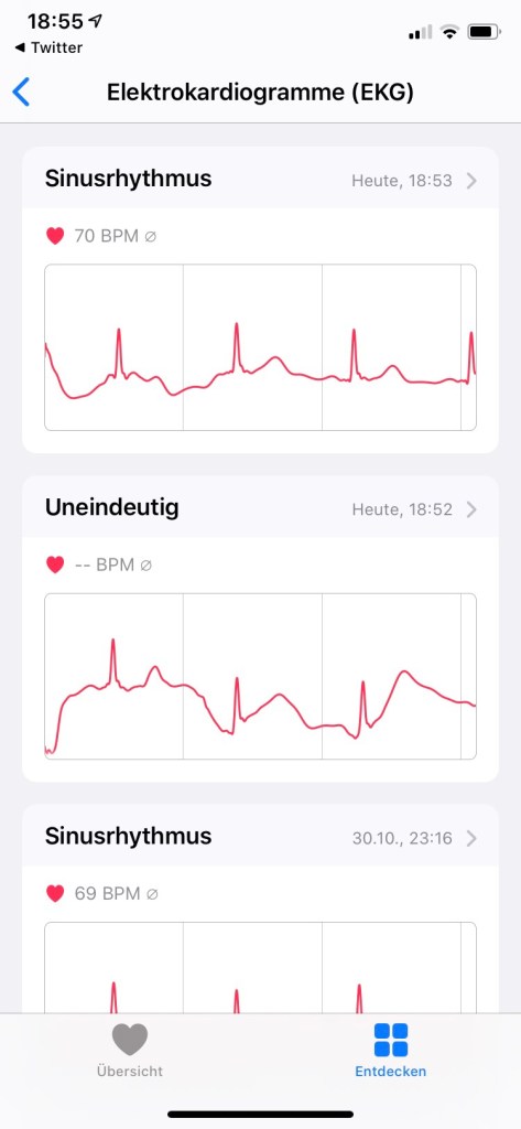 EKG als Ergebnis